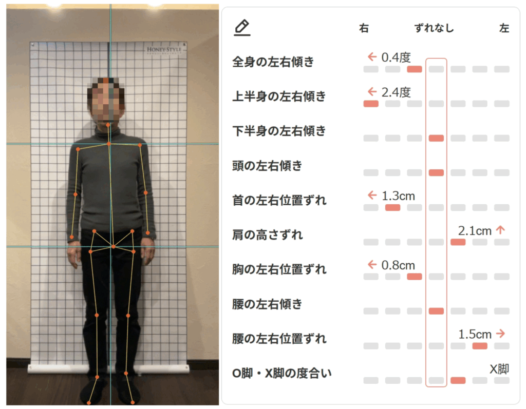 姿勢矯正・姿勢測定診断｜神楽坂矢来整骨院 | 神楽坂矢来整骨院